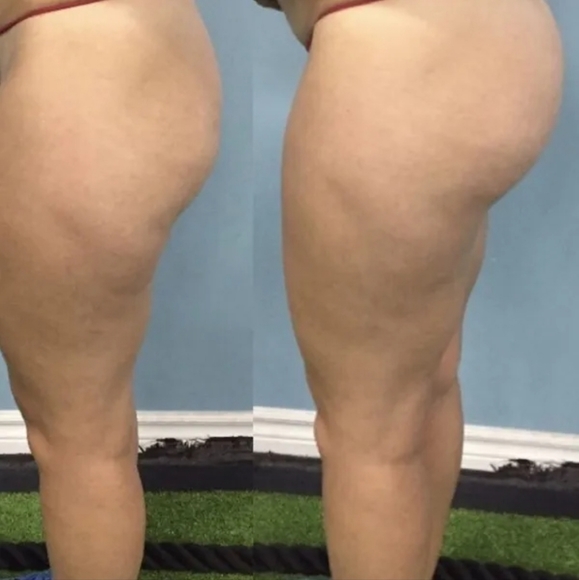 Badonka - Picture 2 of 3